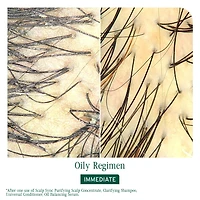 BIOLAGE Scalp Sync Oil Balancing Serum for Oily Scalp