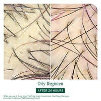 BIOLAGE Scalp Sync Oil Balancing Serum for Oily Scalp