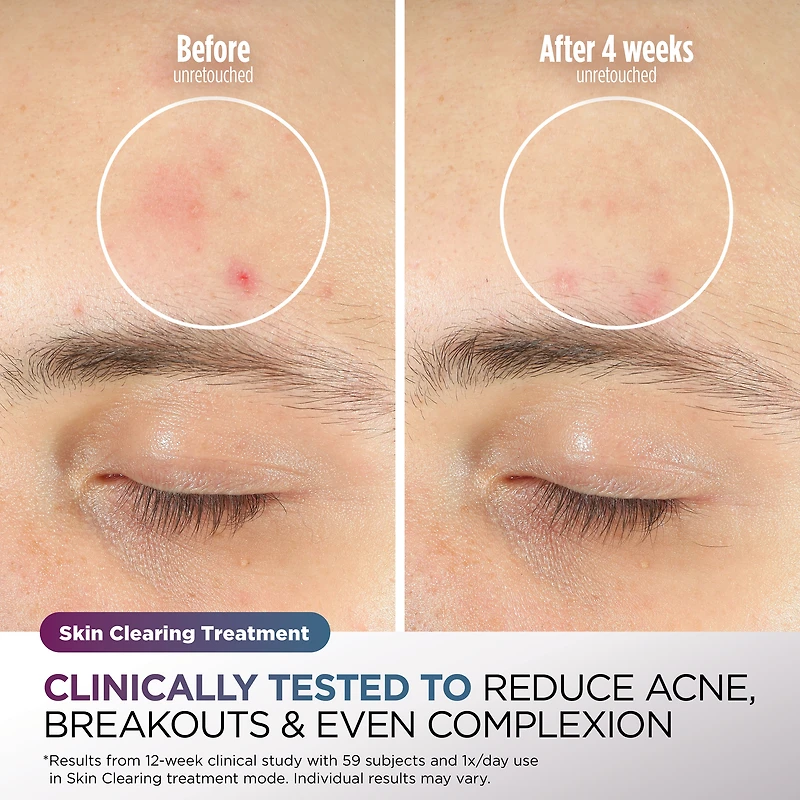 SHARK CryoGlow™ Cooling + LED Face Mask