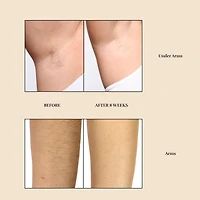 SILK'N Flash&Go Pro Hair Removal with Permanent Results