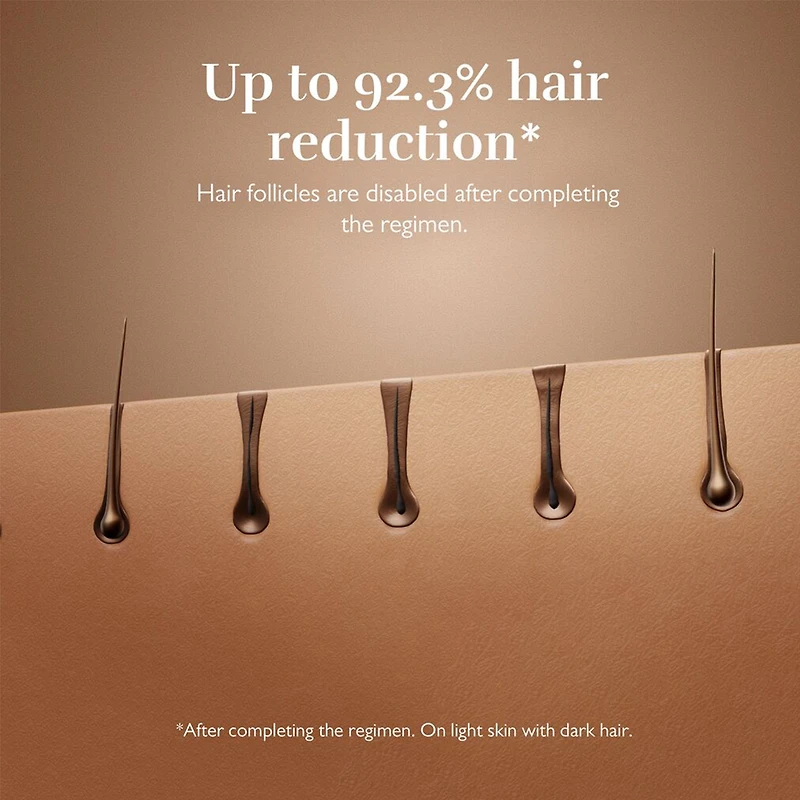 SILK'N Flash&Go Pro Hair Removal with Permanent Results