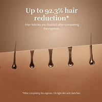 SILK'N Flash&Go Pro Hair Removal with Permanent Results