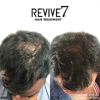Revive7 Hair Oil