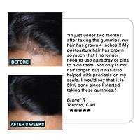 IMARAIS BEAUTY Nourish Haircare Gummies