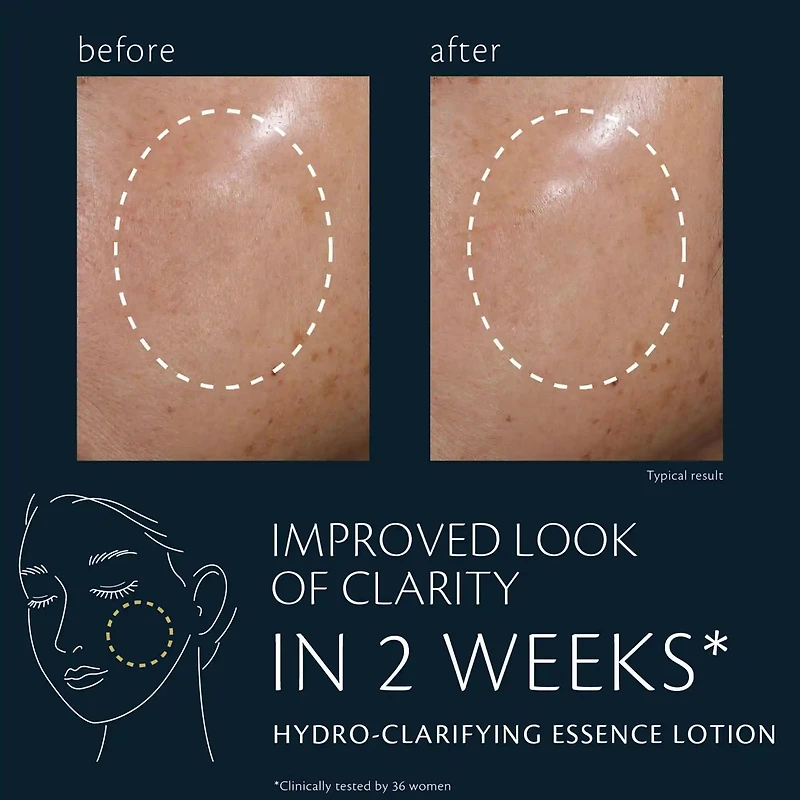 Hydro-clarifying Essence Lotion