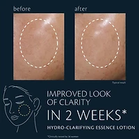 Hydro-clarifying Essence Lotion