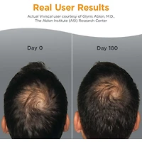 Viviscal Mens Supplement