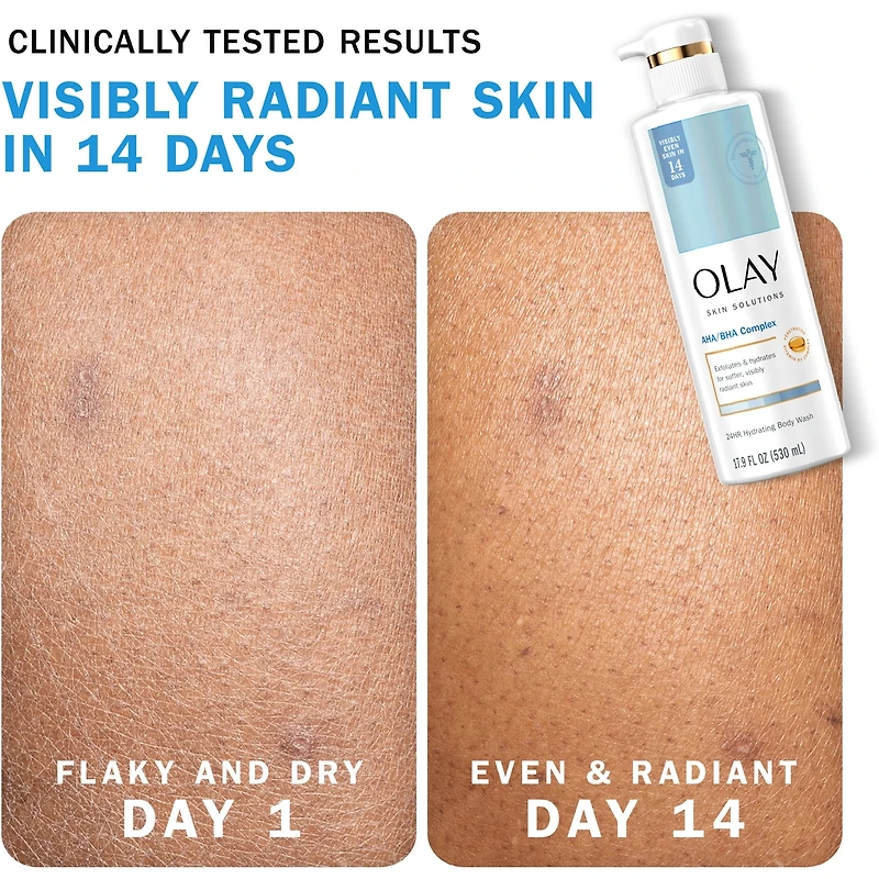 Skin Solutions Body Wash with Salicylic Acid