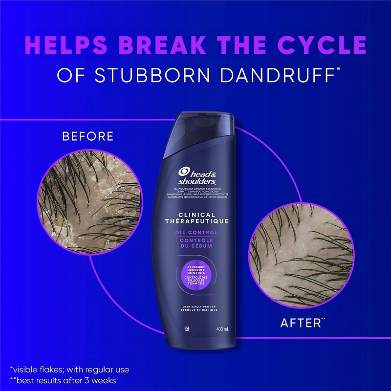 Shampooing Action thérapeutique Contrôle avancé des huiles, 400 mL