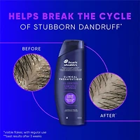 Shampooing Action thérapeutique Contrôle avancé des huiles, 400 mL