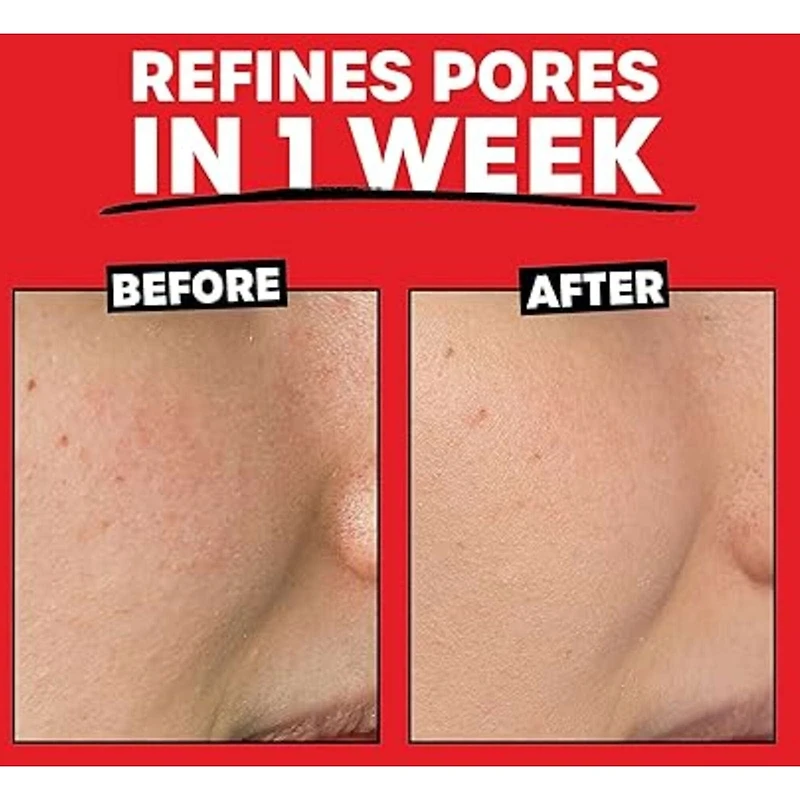 2% AHA Exfoliating Toner with Glycolic Acid, Lactic Acid and Witch Hazel, Smoothing and Pore Refining
