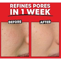 2% AHA Exfoliating Toner with Glycolic Acid, Lactic Acid and Witch Hazel, Smoothing and Pore Refining