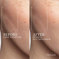 Rénergie H.C.F. Triple Serum Duo