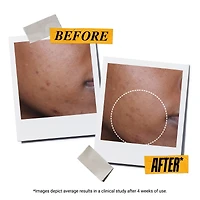 Sérum à écran solaire pour le visage FPS 50+ Beyond Screen® UV avec peptide de collagène