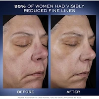 Coffret des fêtes Génifique Ultimate Routine