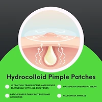 Oxy Invisible Pimple Patches for Acne, 26 Count – Hydrocolloid Pimple Patch with Tweezers, Variety Pack – Absorbs Puss, Long-Lasting, Day & Night Use