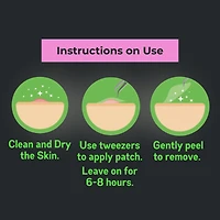 Oxy Invisible Pimple Patches for Acne, 26 Count – Hydrocolloid Pimple Patch with Tweezers, Variety Pack – Absorbs Puss, Long-Lasting, Day & Night Use