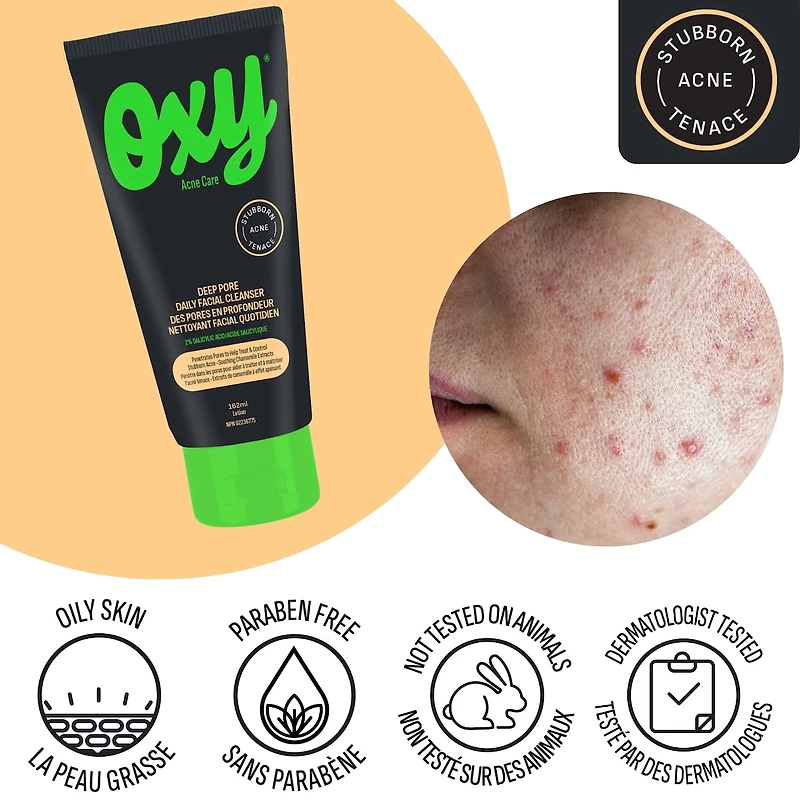 Nettoyant quotidien contre l'acné pour le visage en profondeur avec acide salicylique, pour l'acné tenace, pour les points noirs et les pores visibles