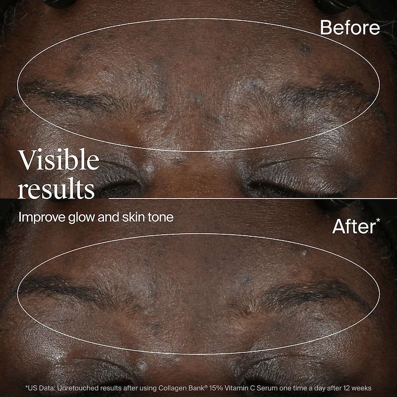 Collagen Bank Sérum à la vitamine C à 15%