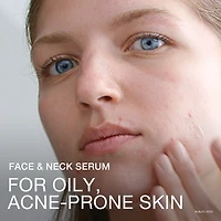 Sérum de niacinamide Texture irrégulière