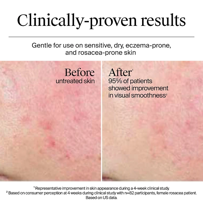 Hydro Boost Extra Dry Gel Cream