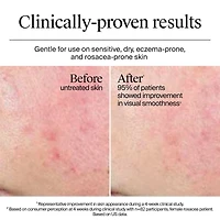 Hydro Boost Extra Dry Gel Cream