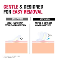 Acne Patches for Sensitive Skin, Two Sizes