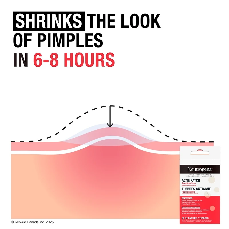 Acne Patches for Sensitive Skin, Two Sizes