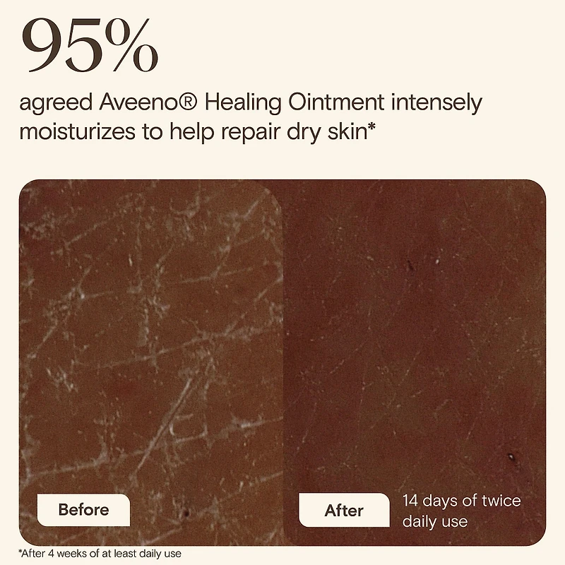 Healing Ointment for Dry, Cracked Skin