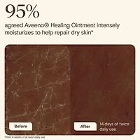 Healing Ointment for Dry, Cracked Skin