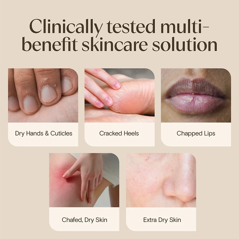 Healing Ointment for Dry, Cracked Skin