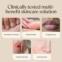 Healing Ointment for Dry, Cracked Skin