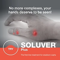 Treatment for resistant warts