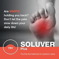 Treatment for resistant warts