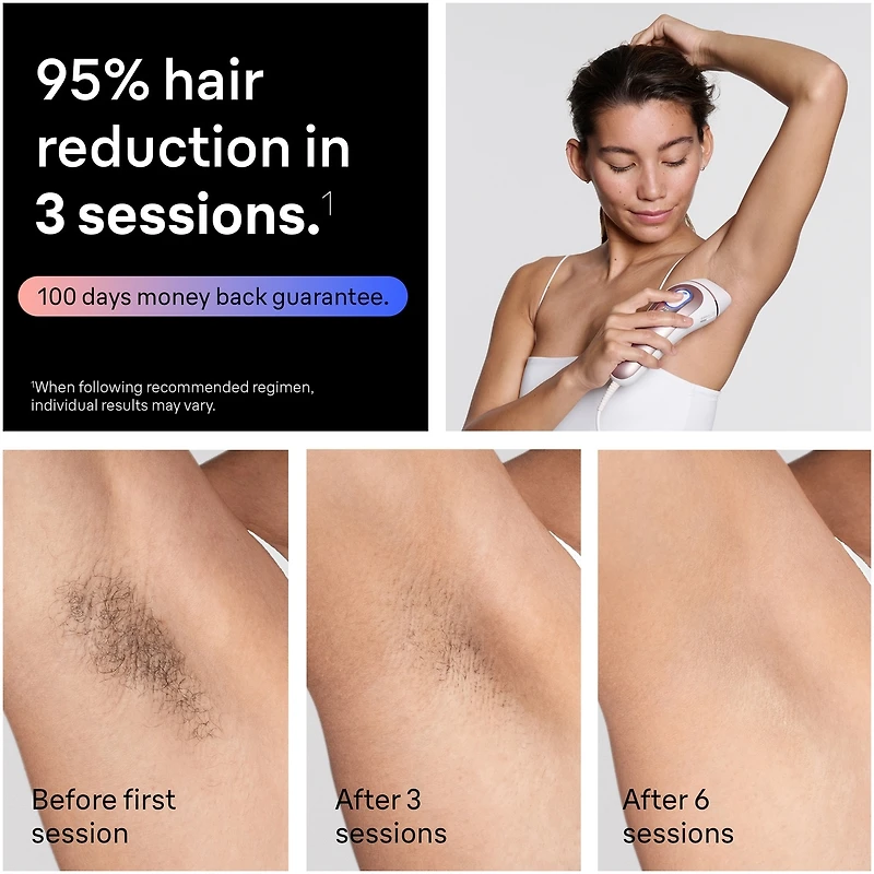 IPL Skin i-expert Laser Hair Removal at Home, Permanent Hair Reduction for Women and Men, Holiday Gifts with Free App, Vanity Case, Razor, 3 Smart Heads, Alter for Laser Hair Removal, PL7243