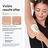 IPL Silk·expert Pro 5 PL5157 IPL for Women and Men, At-Home Hair Removal System, White and Gold, with Soft Pouch and Precision Head