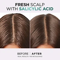 Hair Expertise Hyaluron Pure Revitalisant Réhydratant 72H, pour racines grasses et longueurs déshydratées