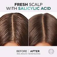 Hyaluron Pure Purifying Shampoo