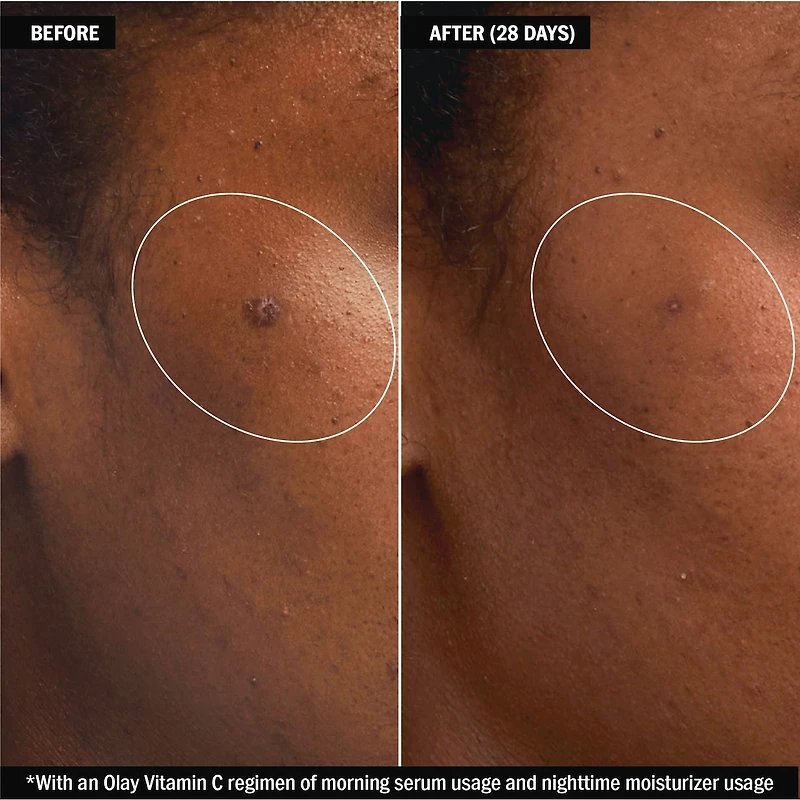 Olay SÉRUMS vitamine C + peptide 24