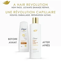 Revitalisant pour cuir chevelu sec et irrité, Dove Soulagement de la Sécheresse et des Démangeaisons  avec technologie Soin Bio-Protéine Liquide, 355 ML