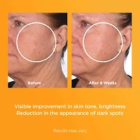 Vitamin C Ceramide Capsules Radiance Renewal Serum