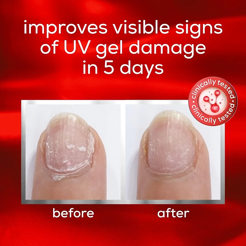 nail repair