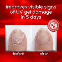 nail repair