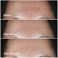Smart Clinical Repair™ Serum