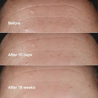 Smart Clinical Repair™ Serum