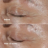 Smart Clinical Repair™ Wrinkle Correcting Eye Cream