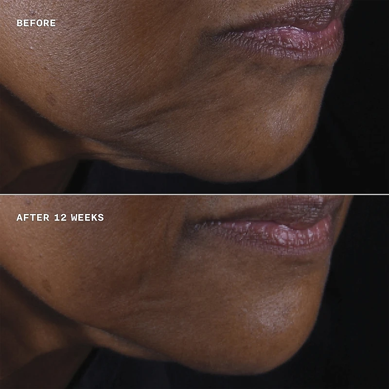crème lifante visage + cou Clinique Smart Clinical Repair™