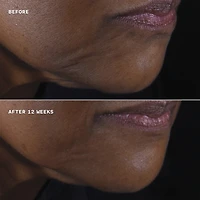 crème lifante visage + cou Clinique Smart Clinical Repair™