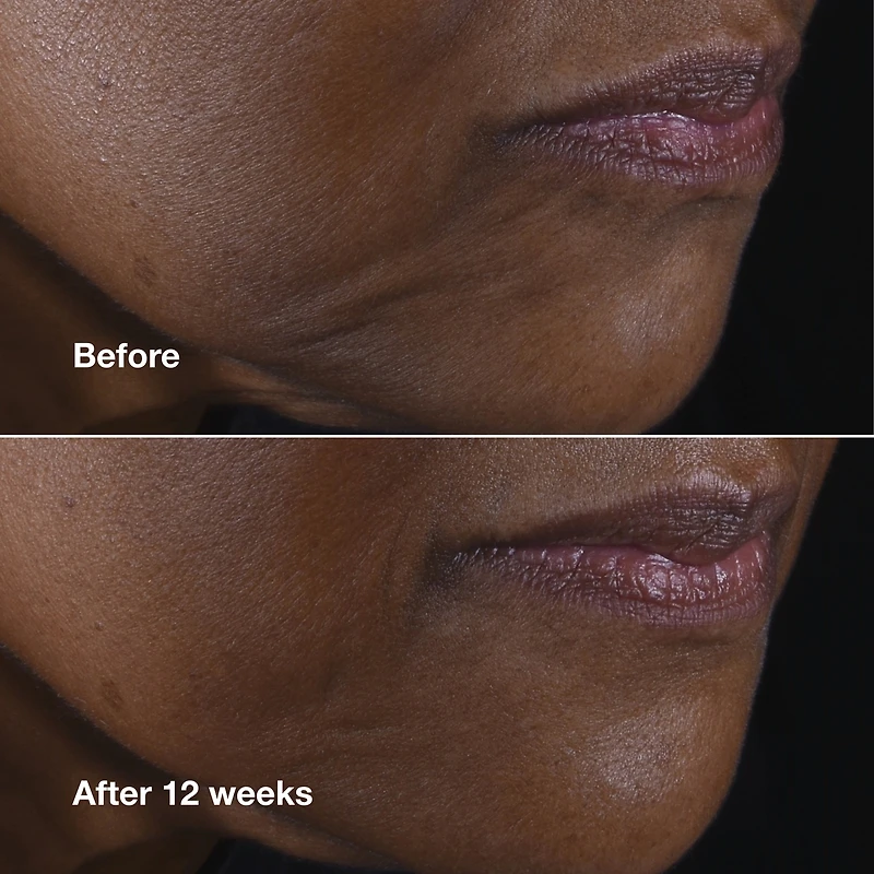 crème lifante visage + cou Clinique Smart Clinical Repair™