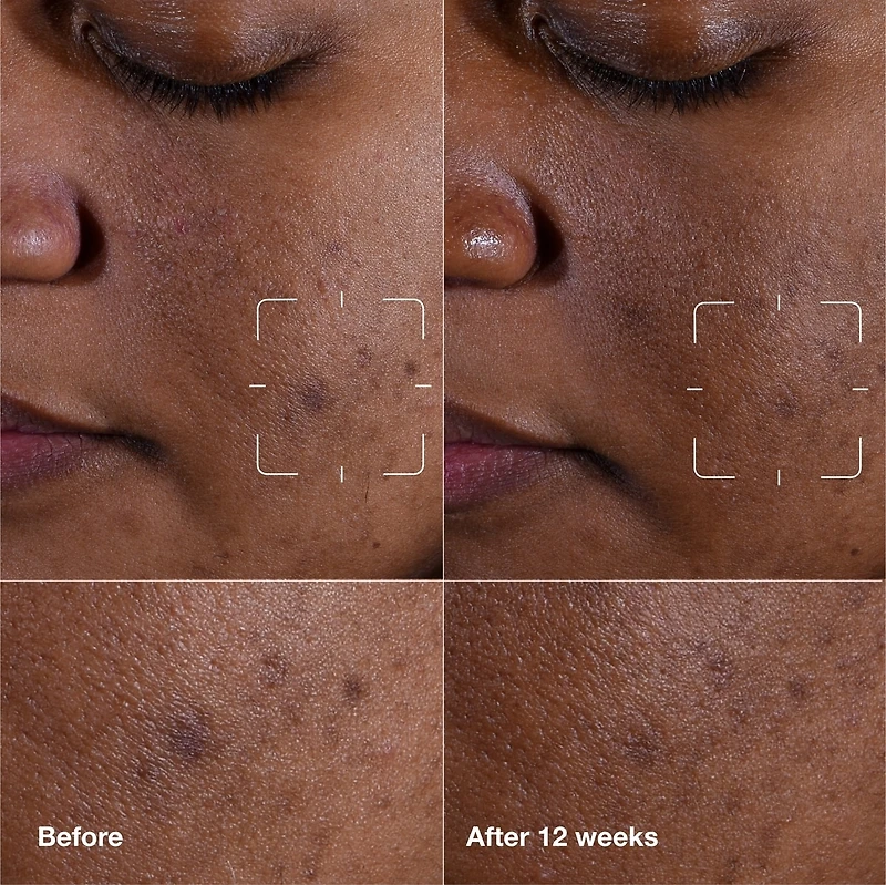 Sérum Anti-Taches Even Better Clinical™